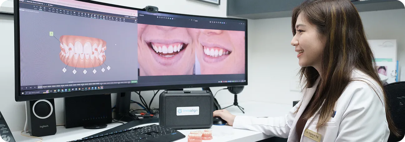The Dental Implant Process LSS