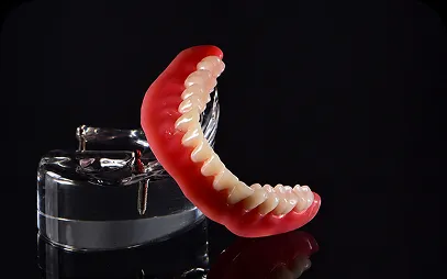 Implant-Supported Dentures